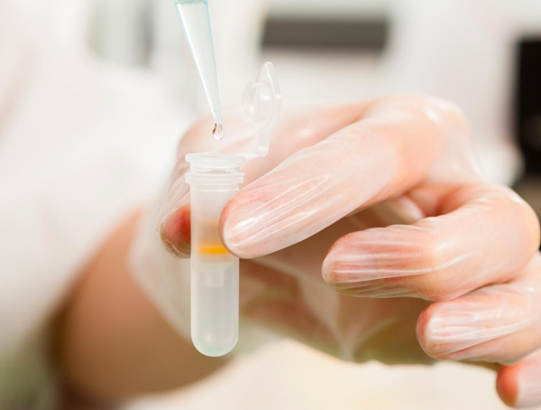 Total RNA Purification