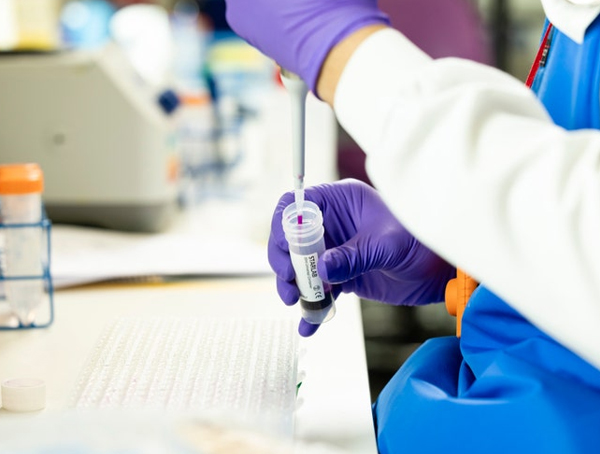 Immuno precipitation (IP)