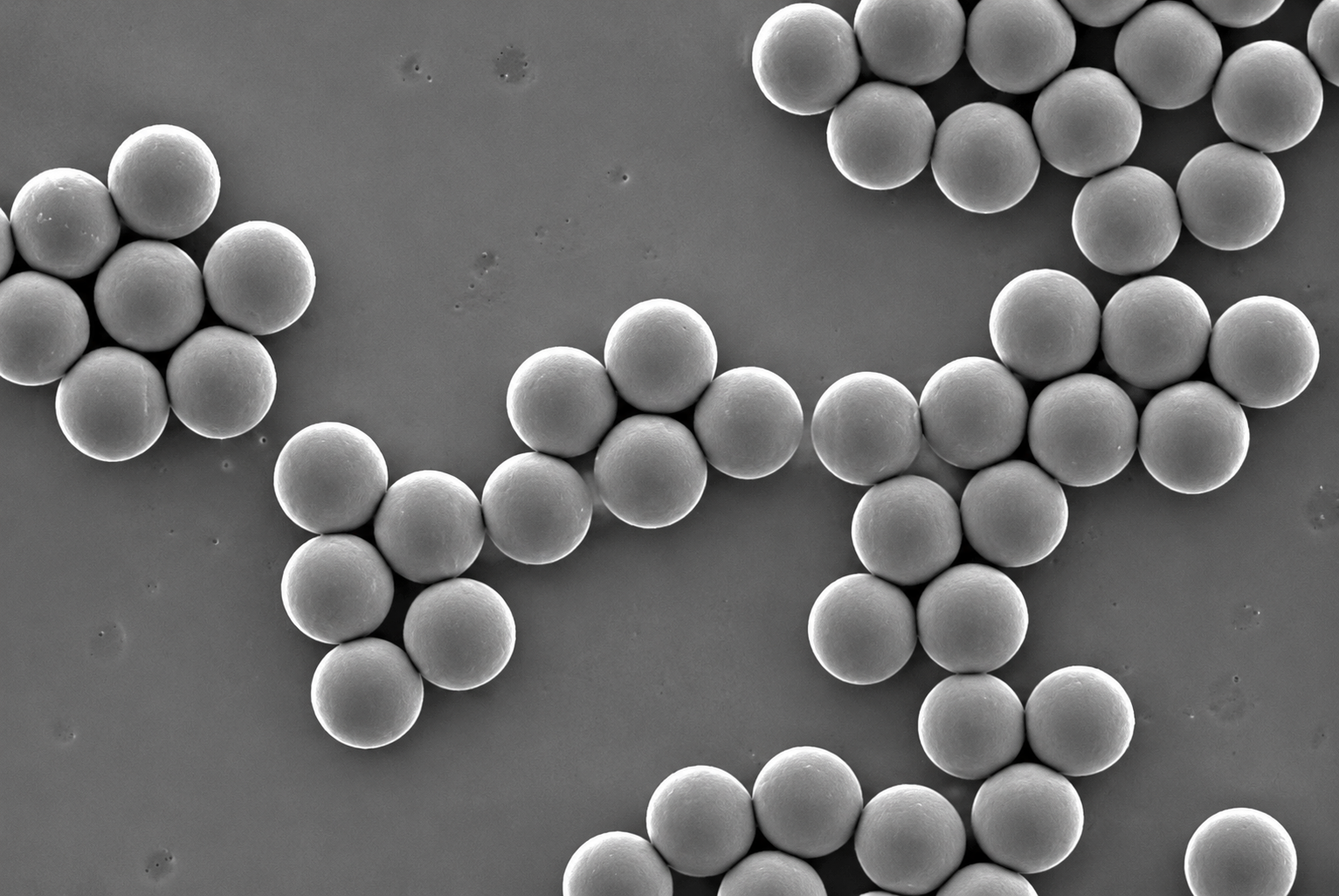 carboxyl-magnetic-beads.png