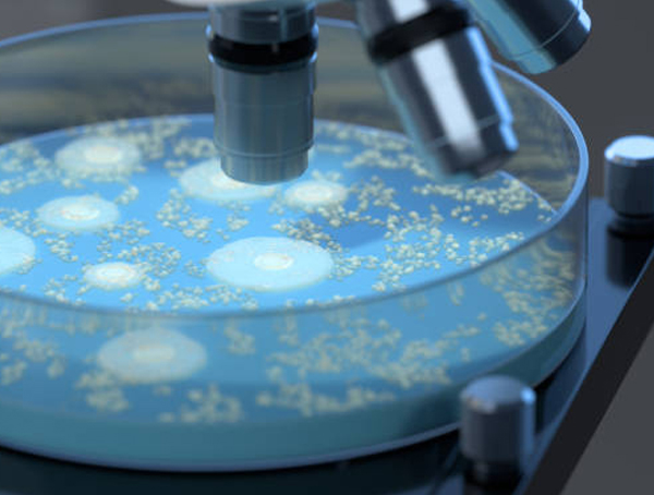 Viral DNA RNA Extraction