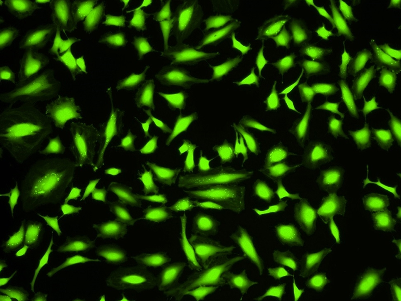 Cell-Labeling-&-Cell-Tracking