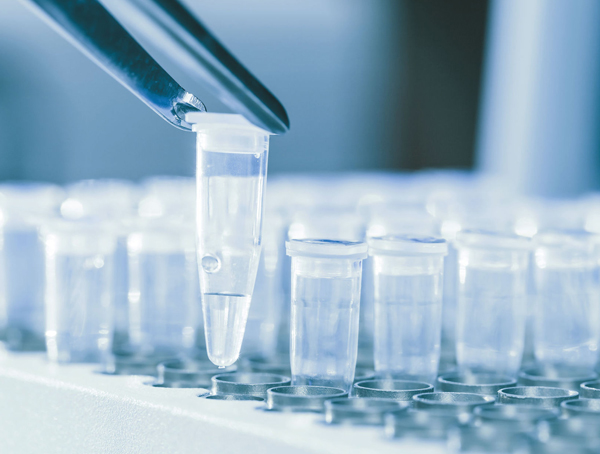 PCR Product Purification