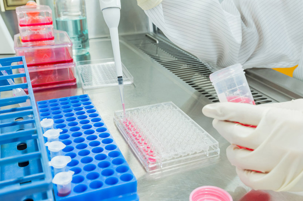 Multiplex Immunoassays