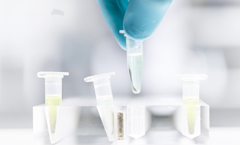 Protein-Purification
